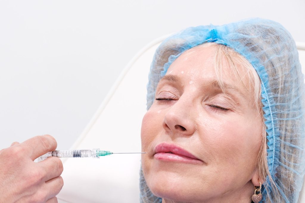 Vertical picture of lips taking hyaluronic acid injections in an aesthetic clinic